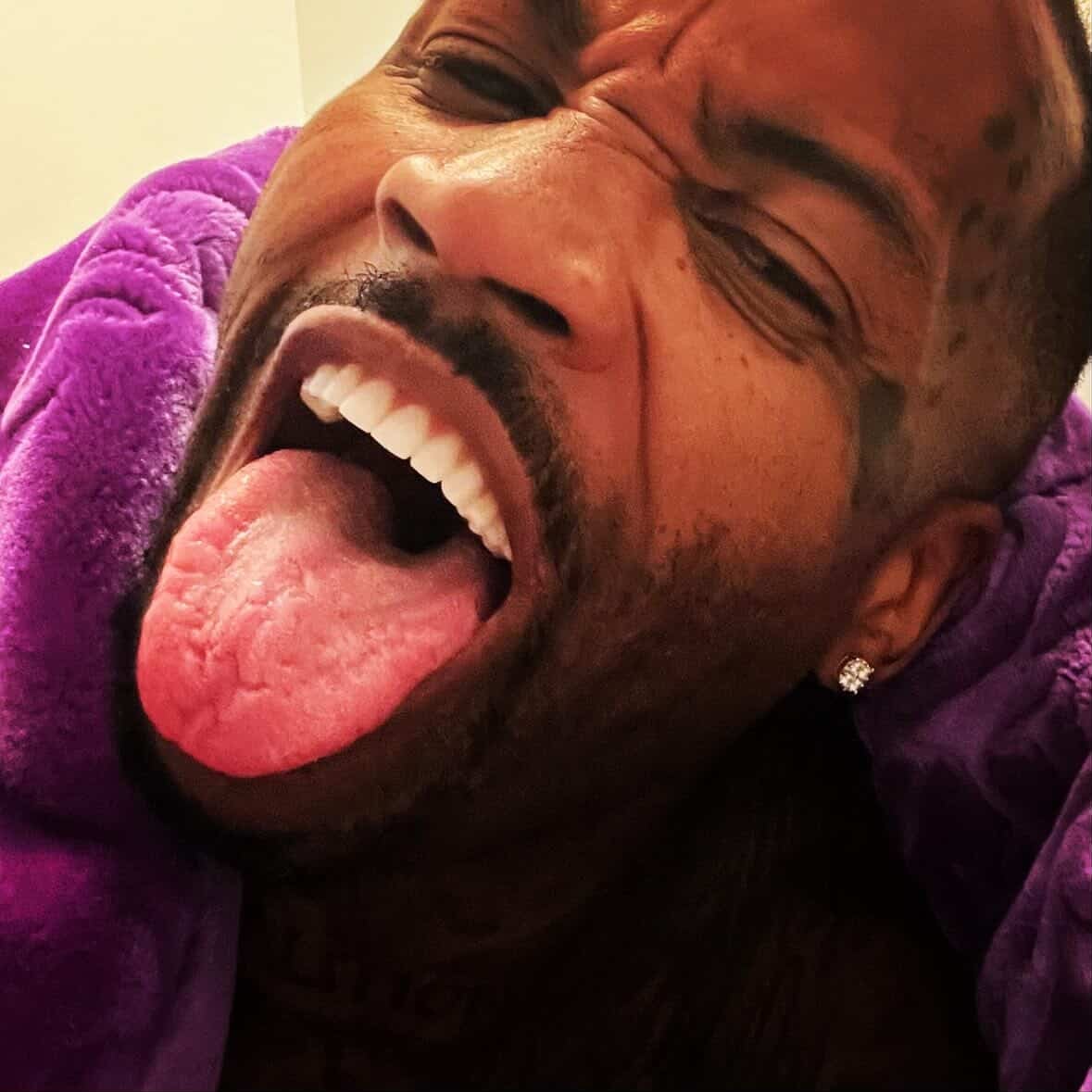 GWAP new teeth smile